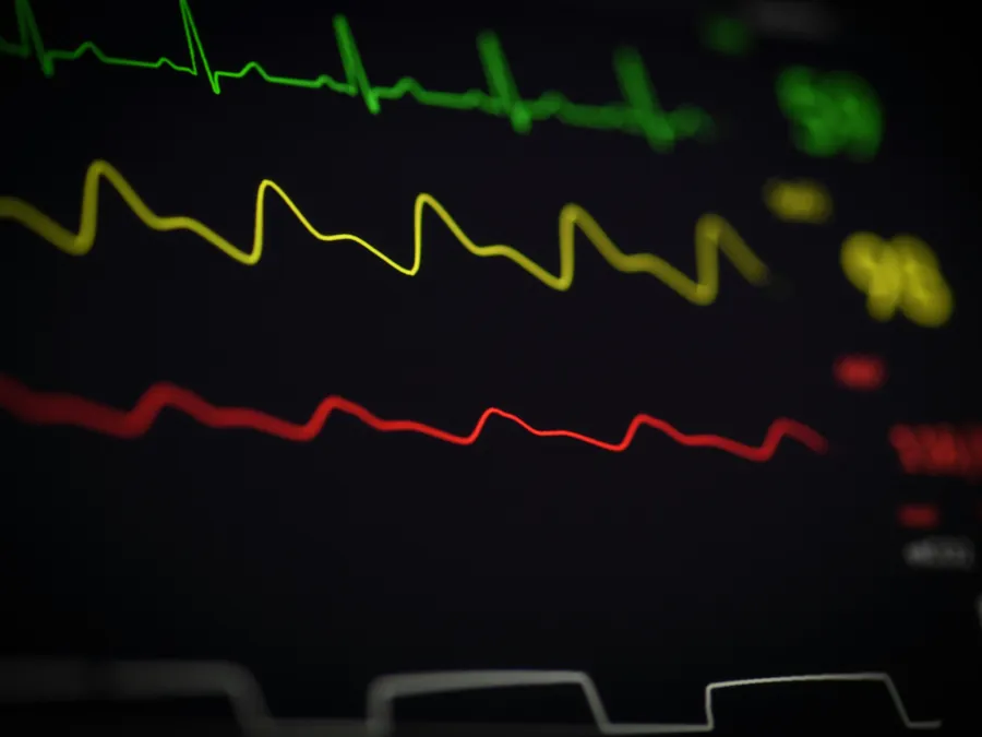 Patientenmonitor mit Herzkurven im Behandlungsraum